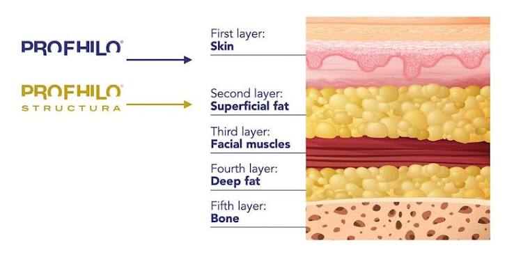 Bio Stimulators |PROFHILO® STRUCTURA