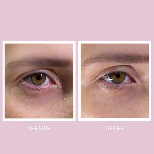Youth Lab Youth Lab Peptides Spring Hydragel Eye Patches