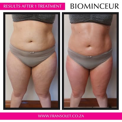 Biominceur Body Wrap