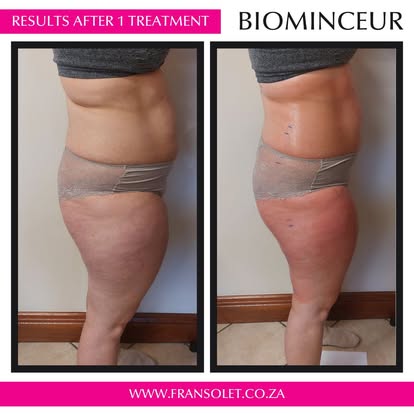 Biominceur Body Wrap