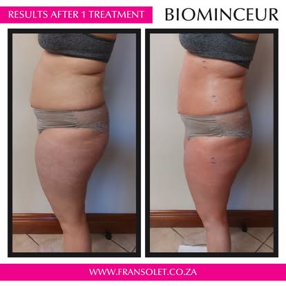 Biominceur Body Wrap