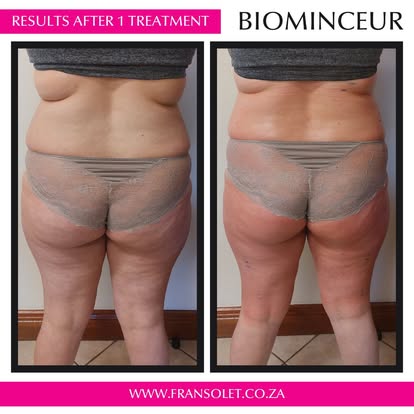 Biominceur Body Wrap