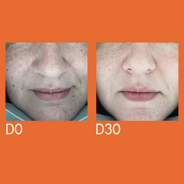 Youth Lab Dark Spot Remover Serum