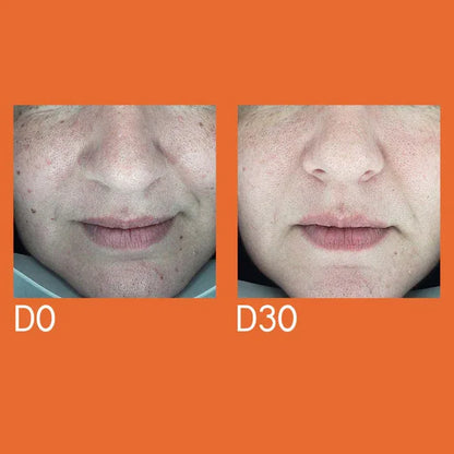 Youth Lab Dark Spot Remover Serum