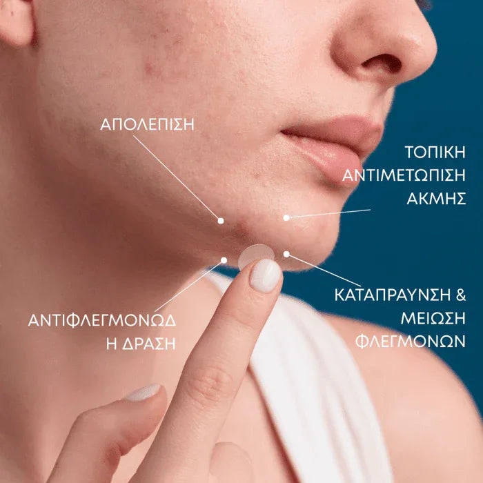 Youth Lab Blemish Dots - Oily / Prone to Imperfections Skin