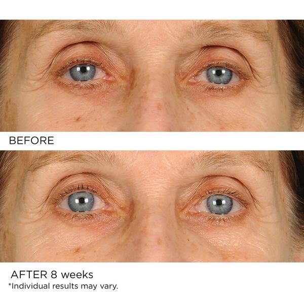 Nassif MD - ANTI-AGING UNDER EYE SMOOTHER