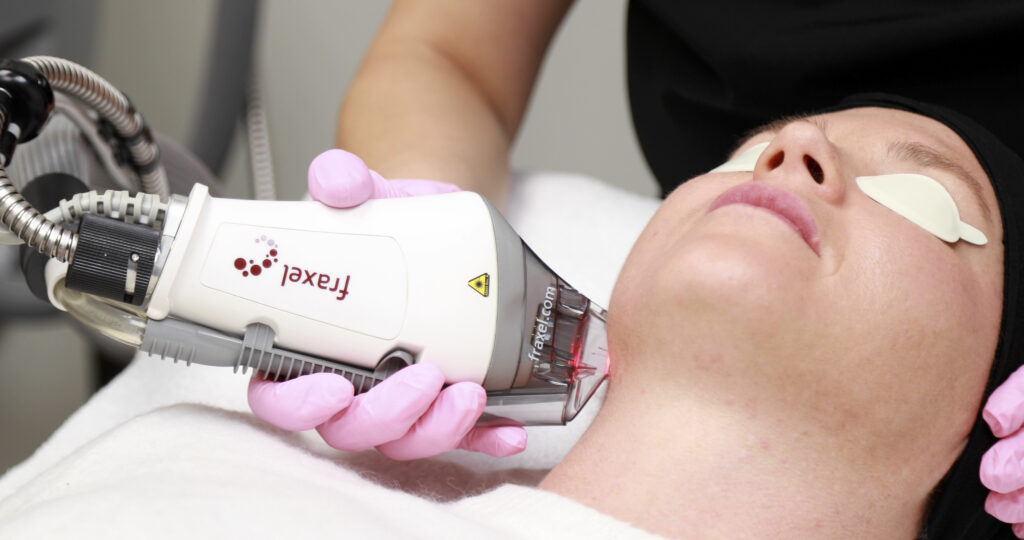 Fraxel® Dual Laser Resurfacing