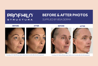 Bio Stimulators |PROFHILO® STRUCTURA