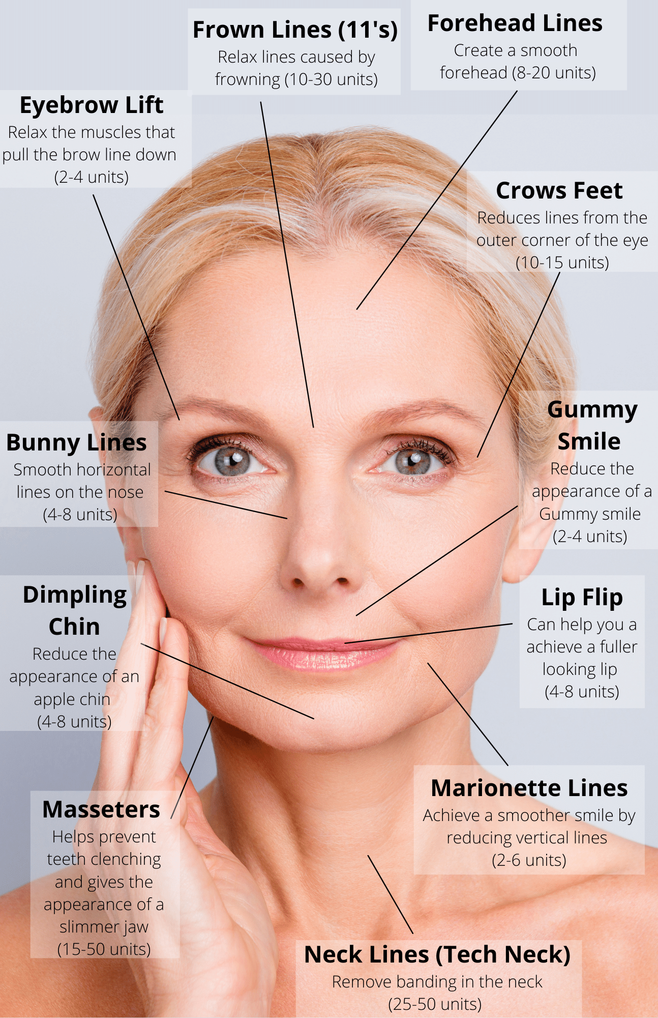 Botox/Dysport