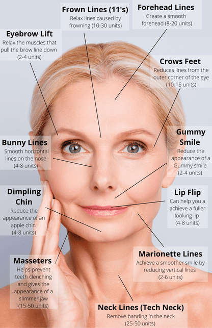 Botox/Dysport