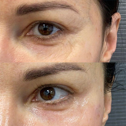 Bio Stimulators | Juvelook