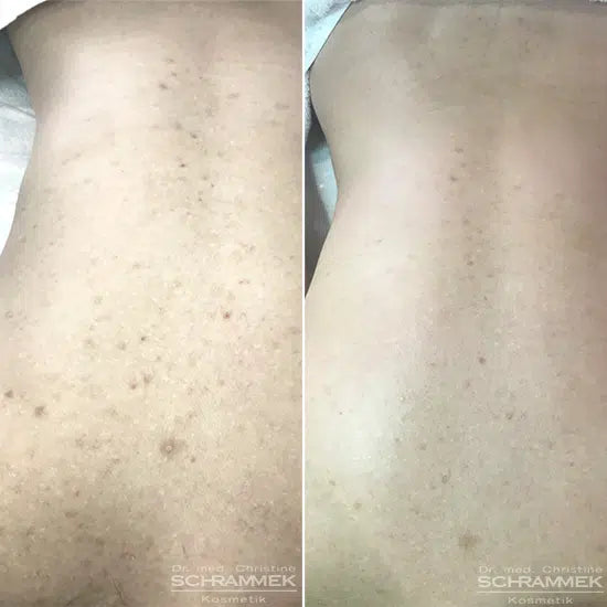 Peels – Dr Schrammek GREEN PEEL