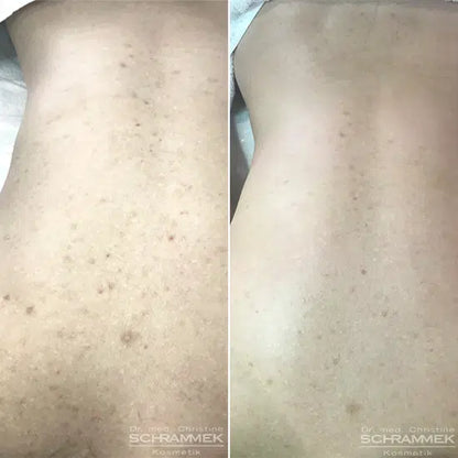Peels – Dr Schrammek GREEN PEEL
