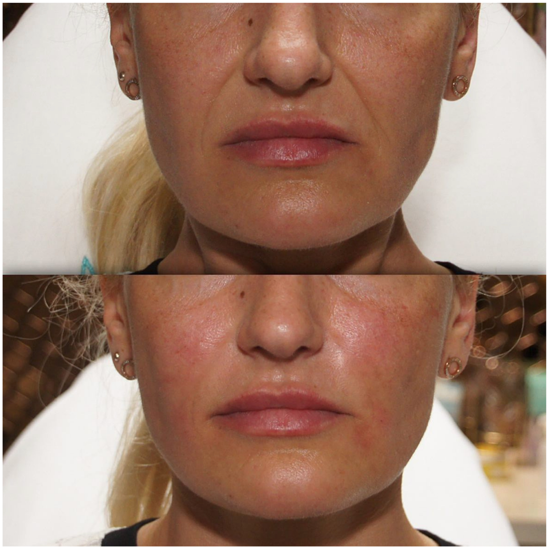 Bio Stimulators | Lenisna
