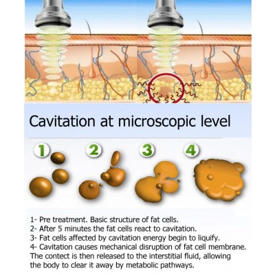 Dainfern Aesthetics - Ultrasound Cavitation Treatment