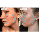 DERMAQUEST Soothing Antioxidant Complex
