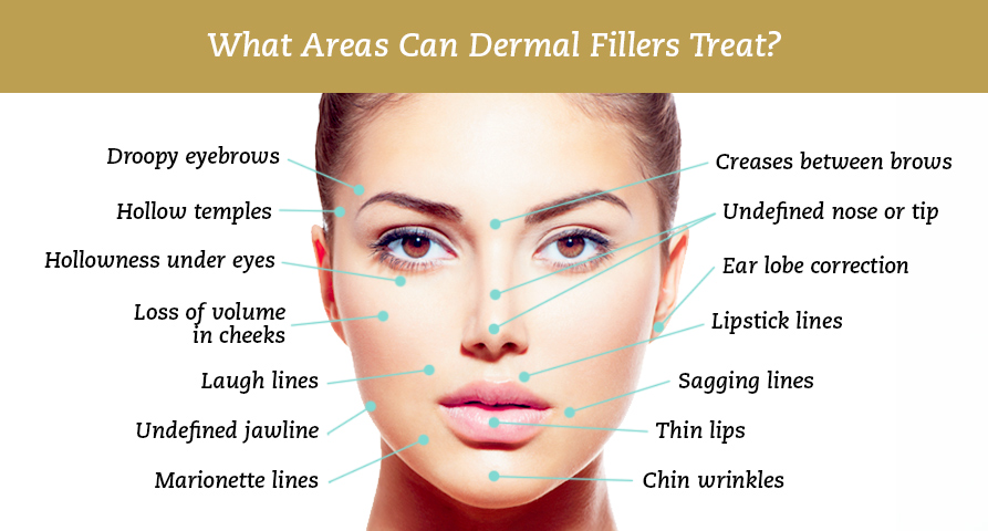 Dainfern Aesthetics - Hyaluronic Acid Fillers