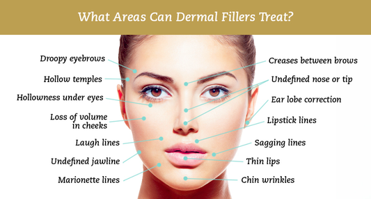 Dainfern Aesthetics - Hyaluronic Acid Fillers