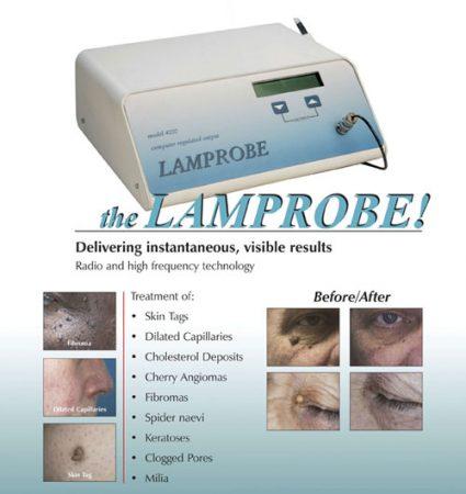 Dainfern Aesthetics - Lamprobe Skin Lesion Removal
