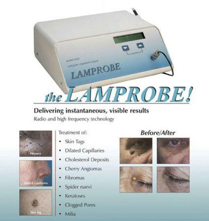 Dainfern Aesthetics - Lamprobe Skin Lesion Removal
