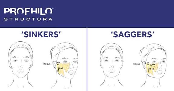 Bio Stimulators |PROFHILO® STRUCTURA