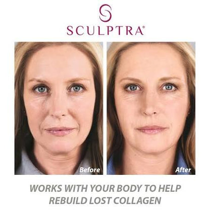 Bio Stimulators | Sculptra