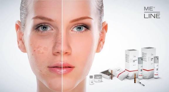 Dainfern Aesthetics - Meline Pigmentation Treatment
