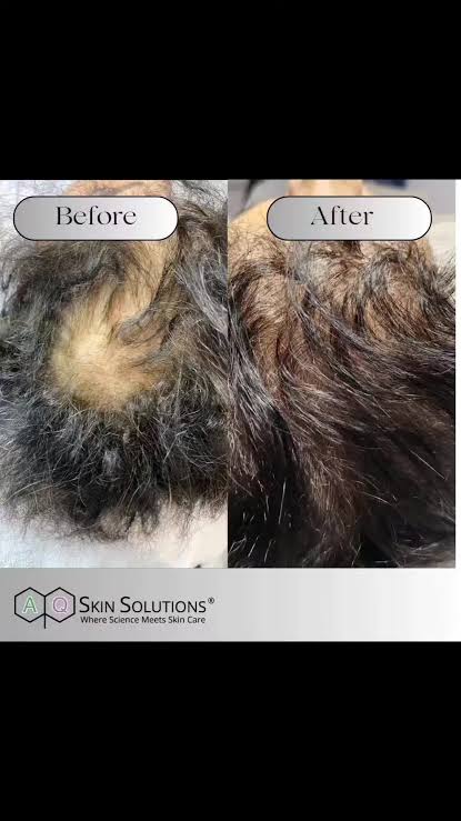 Dainfern Aesthetics - AQ Hair Complex