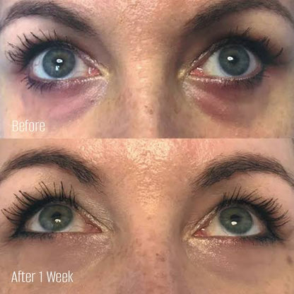 Injectable Skin Booster - Sunekos