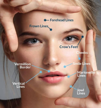 Botox/Dysport