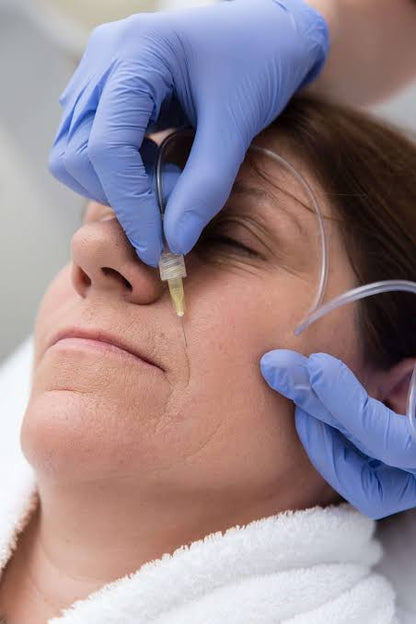 Dainfern Aesthetics - Carboxy Therapy