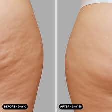 Unicskin - UNICTECH BODY SLIM x4