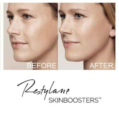 Injectable - Skin Boosters - Restylane Vital / Vital Light