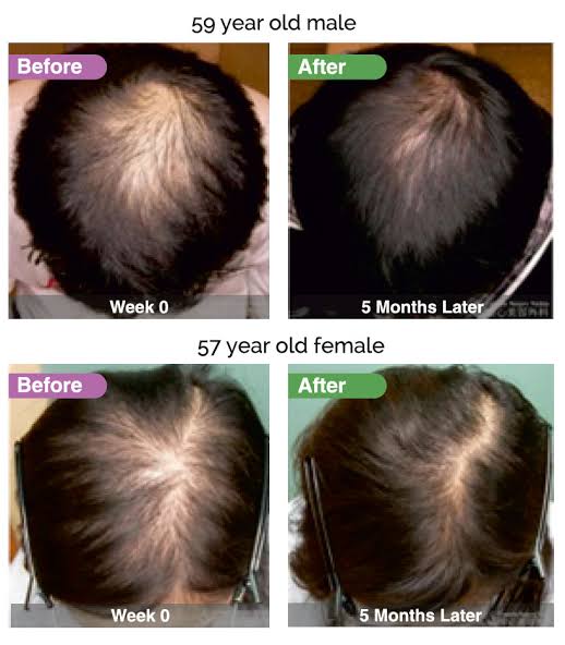 Dainfern Aesthetics - AQ Hair Complex