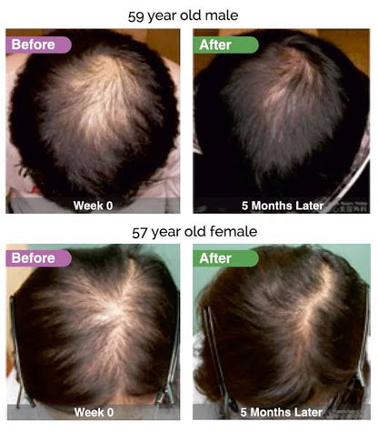 Dainfern Aesthetics - AQ Hair Complex