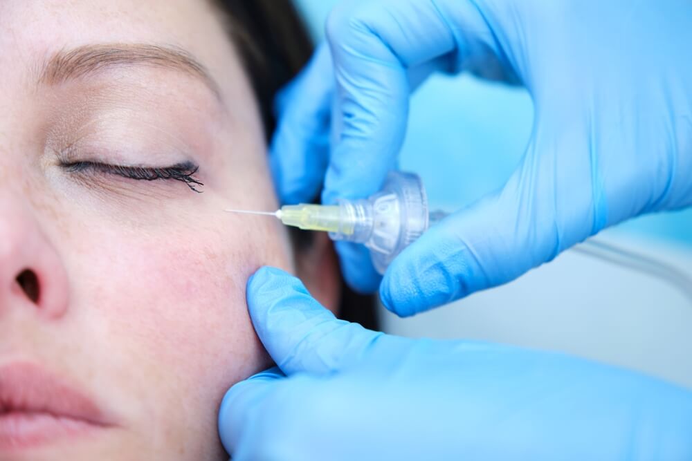 Dainfern Aesthetics - Carboxy Therapy