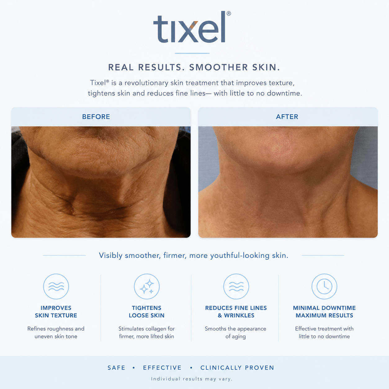 Tixel® Rejuvenation