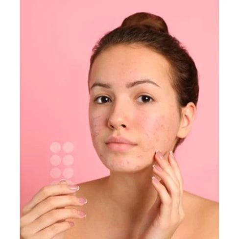 Youth Lab Blemish Dots - Oily / Prone to Imperfections Skin 32 Patches